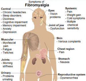 Symptoms_of_fibromyalgia